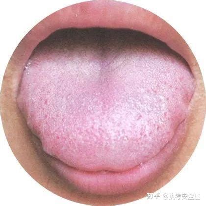 舌苔薄白